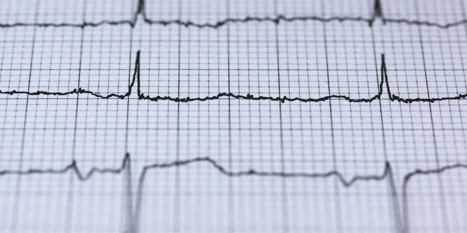 duree de vie defibrillateur